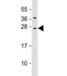 CIDE B Antibody