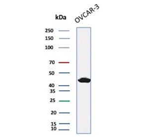 Western blot testing of human OVCAR-3 cell lysate with Mesothelin antibody (clone MSLN/2132). Predic
