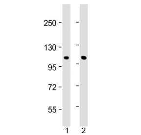 Western blot testing of 1) human skeletal muscle and 2) mouse skeletal muscle with CLCN1 antibody at