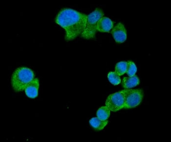Immunofluorescent staining of FFPE human T-47D cells with UBAP2L antibody (green) and DAPI nuclear s