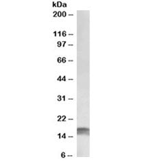 Western blot testing of HeLa lysate with CDKN2A antibody at 1ug/ml. Predicted molecular ~12kDa, obse