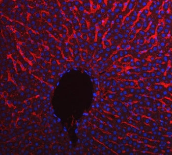 ApoE Antibody / Apolipoprotein E