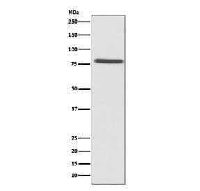 Western blot testing of human HeLa cell lysate with Ezrin antibody. Expected molecular weight: 70-80