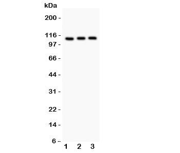 Western blot testing of TRPC5 antibody and Lane 1: HeLa; 2: U87; 3: COLO320. Expected size ~111KD
