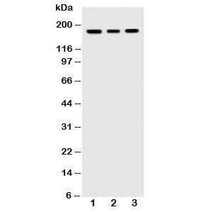Western blot testing of VEGFR antibody and human cell lysates: 1) MCF-7; 2) SGC; 3) MM231. Predicted