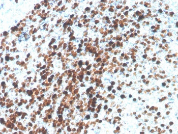 IHC staining of FFPE human tonsil with recombinant TOP2A antibody. HIER: boil tissue sections in pH 