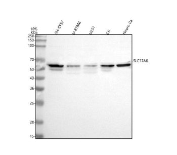 Western blot analysis of VGLUT2/SLC17A6 using anti-SLC17A6 antibody. Lane 1: human SH-SY5Y whole cel