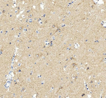 IHC staining of FFPE human brain tissue with MAOB antibody, HRP-secondary and DAB substrate. HIER: b