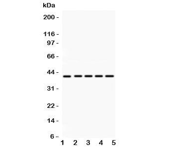 Western blot testing of HOXA10 antibody and Lane 1: rat kidney; 2: human placenta; 3: (h) HeLa; 4: (