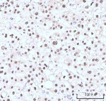Nesprin 3 Antibody / SYNE3