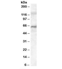 Western blot testing of rat liver lysate with IRAK3 antibody at 0.05ug/ml. Predicted molecular weigh