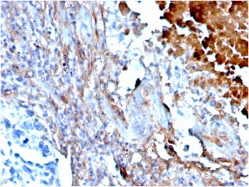IHC staining of FFPE human lung with Fibronectin antibody (clone FN1/3568). HIER: boil tissue sectio