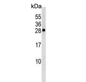 Western blot testing of human K562 cell lysate with CXXC4 antibody. Predicted molecular weight ~21 k