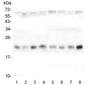 Western blot testing of human 1) HeLa, 2) placenta, 3) Caco-2, 4) T-47D, 5) U-87 MG, 6) K562, 7) U-2