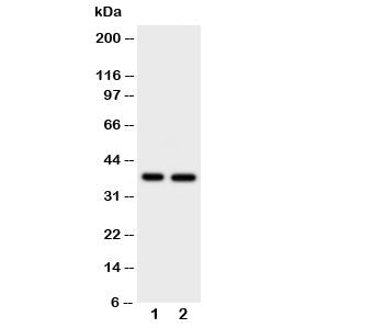 Western blot testing of MCL-1 antibody and Lane 1: HeLa; 2: MCF-7 cell lysate. Predicted molecular w