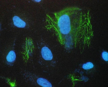 Immunofluorescent staining of FFPE human A431 cells with SCNN1A antibody (green) and DAPI nuclear st