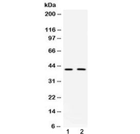 Western blot testing of 1) rat brain and 2) mouse brain with DCX antibody at 0.5ug/ml. Predicted mol