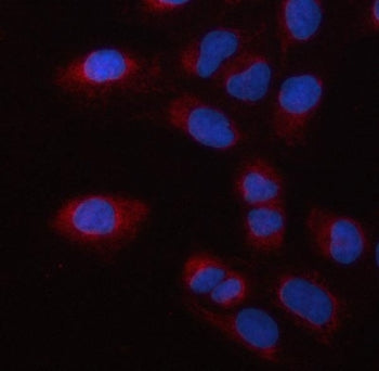PSMC2 Antibody / Proteasome 19S S7 / MSS1