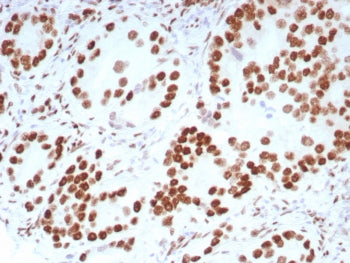 Androgen Receptor Antibody