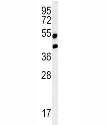 Western blot analysis of AGER / RAGE in mouse lung tissue lysate. Predicted molecular weight: 45-55k