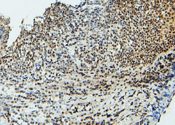 IHC staining of FFPE human tonsil with UBC9 antibody. HIER: boil tissue sections in pH6, 10mM citrat