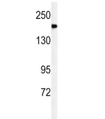 Western blot analysis of A2ML1 antibody and mouse lung tissue lysate. Predicted molecular weight ~16