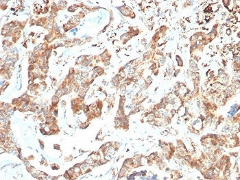 BCMA Antibody / CD269 / TNFRSF17