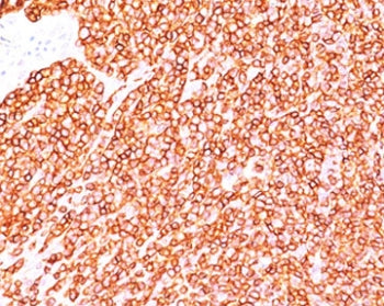 CD45RB Antibody (B-cell marker)