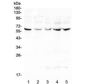 Western blot testing of human 1) placenta, 2) Caco-2, 3) CCRF-CEM, 4) HeLa and 5) Jurkat lysate with