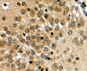 IHC testing of FFPE human hippocampus with NOTCH3 antibody at 4ug/ml. HIER: steamed with pH6 citrate