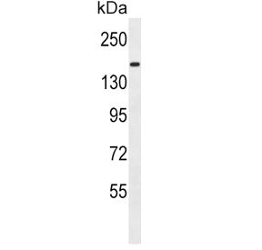Western blot testing of human MDA-MB-435 cell lysate with Protocadherin 9 antibody. Expected molecul