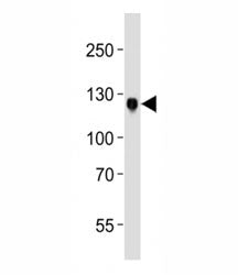 DDR1 Antibody