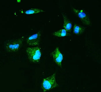 Immunofluorescent staining of FFPE human A549 cells with SLC2A9 antibody (green) and DAPI nuclear st