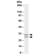 Western blot testing of human testis lysate with COMT antibody at 0.3ug/ml. Predicted molecular weig