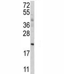 ATG12 Antibody