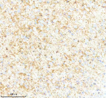 IHC analysis of SYNPR using anti-SYNPR antibody. SYNPR was detected in a paraffin-embedded section o