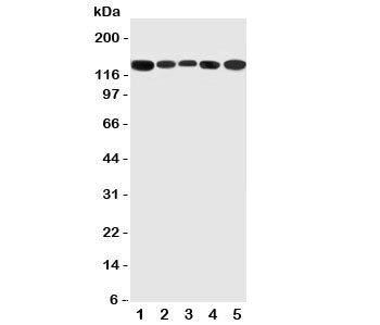 Western blot testing of RGS3 antibody and Lane 1: rat testis; 2: (r) brain; 3: (r) spleen; 4: human 