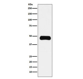 Western blot testing of human Daudi cell lysate with ETS1 antibody. Predicted molecular weight ~51 k