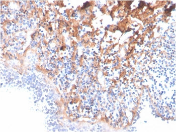 FN1 Antibody / Fibronectin (Total)
