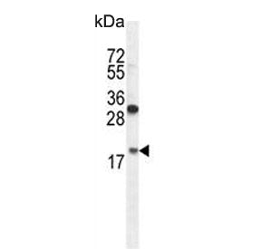 Western blot testing of hamster CHO cell lysate with RPL27A antibody. Predicted molecular weight ~17