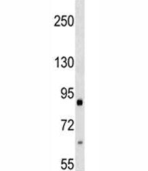 Integrin beta 2 antibody western blot analysis in 293 lysate. Predicted/Observed molecular weight: 8