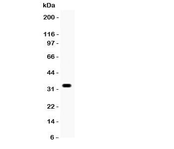 Western blot testing of Otx2 antibody and COLO320 lysate. Predicted/observed size ~32KD