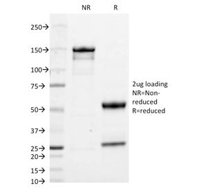 IgA Heavy Chain Antibody