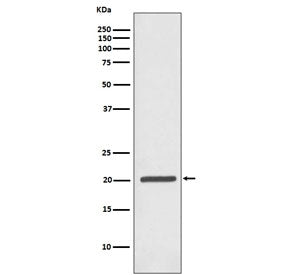Western blot testing of human Jurkat antibody with Ferritin antibody. Predicted molecular weight ~21