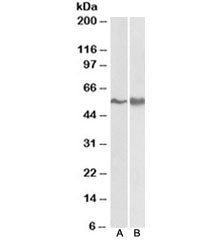 Western blot testing of A431 [A] and Jurkat lysate [B] with FYN antibody at 0.3ug/ml. Predicted mole