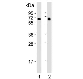 Western blot testing of human 1) liver and 2) lung lysate with IDUA antibody. Expected molecular wei