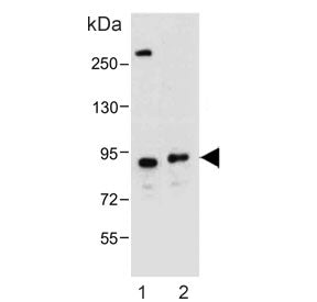 Western blot testing of human 1) U-87 MG and 2) C2C12 cell lysate with Dystrobrevin alpha antibody. 
