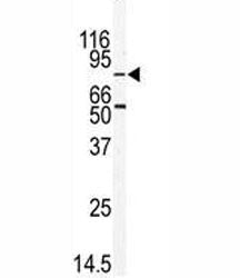Western blot analysis of MARK2 antibody and mouse thymus tissue lysate. Predicted molecular weight: 