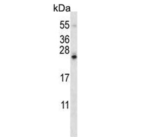 SDF2L1 Antibody / SDF2-like protein 1