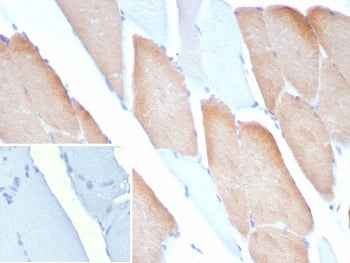 IHC staining of FFPE human skeletal muscle tissue with MYH7 antibody (clone MYH7/9183). Inset: PBS u